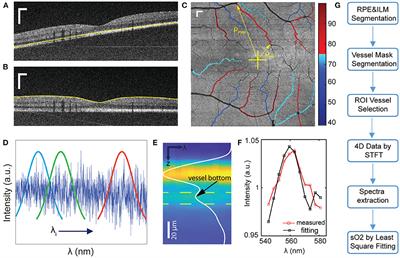 A Baseline Study of Oxygen Saturation in Parafoveal Vessels Using Visible Light Optical Coherence Tomography